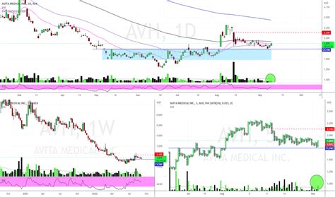 avh share price|AVH Stock Price Quote .